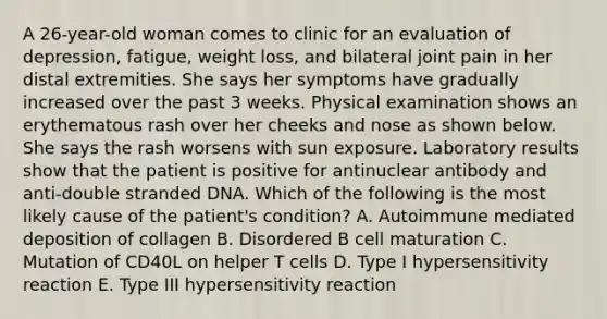 A 26-year-old woman comes to clinic for an evaluation of depression, fatigue, weight loss, and bilateral joint pain in her distal extremities. She says her symptoms have gradually increased over the past 3 weeks. Physical examination shows an erythematous rash over her cheeks and nose as shown below. She says the rash worsens with sun exposure. Laboratory results show that the patient is positive for antinuclear antibody and anti-double stranded DNA. Which of the following is the most likely cause of the patient's condition? A. Autoimmune mediated deposition of collagen B. Disordered B cell maturation C. Mutation of CD40L on helper T cells D. Type I hypersensitivity reaction E. Type III hypersensitivity reaction