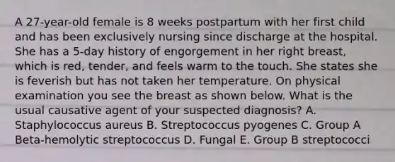 A 27-year-old female is 8 weeks postpartum with her first child and has been exclusively nursing since discharge at the hospital. She has a 5-day history of engorgement in her right breast, which is red, tender, and feels warm to the touch. She states she is feverish but has not taken her temperature. On physical examination you see the breast as shown below. What is the usual causative agent of your suspected diagnosis? A. Staphylococcus aureus B. Streptococcus pyogenes C. Group A Beta-hemolytic streptococcus D. Fungal E. Group B streptococci