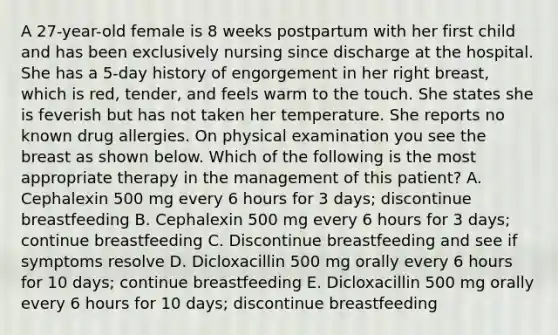 A 27-year-old female is 8 weeks postpartum with her first child and has been exclusively nursing since discharge at the hospital. She has a 5-day history of engorgement in her right breast, which is red, tender, and feels warm to the touch. She states she is feverish but has not taken her temperature. She reports no known drug allergies. On physical examination you see the breast as shown below. Which of the following is the most appropriate therapy in the management of this patient? A. Cephalexin 500 mg every 6 hours for 3 days; discontinue breastfeeding B. Cephalexin 500 mg every 6 hours for 3 days; continue breastfeeding C. Discontinue breastfeeding and see if symptoms resolve D. Dicloxacillin 500 mg orally every 6 hours for 10 days; continue breastfeeding E. Dicloxacillin 500 mg orally every 6 hours for 10 days; discontinue breastfeeding