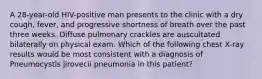 A 28-year-old HIV-positive man presents to the clinic with a dry cough, fever, and progressive shortness of breath over the past three weeks. Diffuse pulmonary crackles are auscultated bilaterally on physical exam. Which of the following chest X-ray results would be most consistent with a diagnosis of Pneumocystis jirovecii pneumonia in this patient?