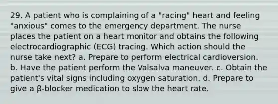 29. A patient who is complaining of a "racing" heart and feeling "anxious" comes to the emergency department. The nurse places the patient on a heart monitor and obtains the following electrocardiographic (ECG) tracing. Which action should the nurse take next? a. Prepare to perform electrical cardioversion. b. Have the patient perform the Valsalva maneuver. c. Obtain the patient's vital signs including oxygen saturation. d. Prepare to give a β-blocker medication to slow the heart rate.