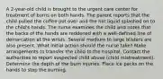 A 2-year-old child is brought to the urgent care center for treatment of burns on both hands. The parent reports that the child pulled the coffee pot over and the hot liquid splashed on to the child's hands. The nurse examines the child and notes that the backs of the hands are reddened with a well-defined line of demarcation at the wrists. Several medium to large blisters are also present. What initial action should the nurse take? Make arrangements to transfer the child to the hospital. Contact the authorities to report suspected child abuse (child mistreatment). Determine the depth of the burn injuries. Place ice packs on the hands to stop the burning.