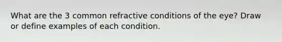 What are the 3 common refractive conditions of the eye? Draw or define examples of each condition.