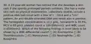 30. A 23-year-old woman has noticed that she develops a skin rash if she spends prolonged periods outdoors. She has a malar skin rash on physical examination. Laboratory studies include a positive ANA test result with a titer of 1 : 1024 and a "rim" pattern. An anti-double-stranded DNA test result also is positive. The hemoglobin concentration is 12.1 g/dL, hematocrit is 35.5%, MCV is 89 μm3, platelet count is 109,000/mm3, and WBC count is 4500/mm3. Which of the following findings is most likely to be shown by a WBC differential count? □ (A) Eosinophilia □ (B) Thrombocytosis □ (C) Monocytosis □ (D) Neutrophilia □ (E) Basophilia