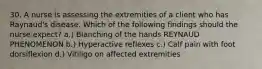 30. A nurse is assessing the extremities of a client who has Raynaud's disease. Which of the following findings should the nurse expect? a.) Blanching of the hands REYNAUD PHENOMENON b.) Hyperactive reflexes c.) Calf pain with foot dorsiflexion d.) Vitiligo on affected extremities