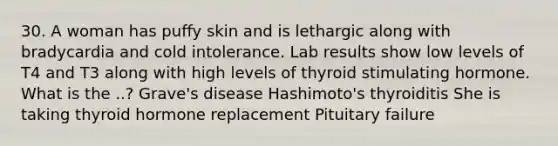 30. A woman has puffy skin and is lethargic along with bradycardia and cold intolerance. Lab results show low levels of T4 and T3 along with high levels of thyroid stimulating hormone. What is the ..? Grave's disease Hashimoto's thyroiditis She is taking thyroid hormone replacement Pituitary failure