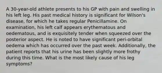 A 30-year-old athlete presents to his GP with pain and swelling in his left leg. His past medical history is significant for Wilson's disease, for which he takes regular Penicillamine. On examination, his left calf appears erythematous and oedematous, and is exquisitely tender when squeezed over the posterior aspect. He is noted to have significant peri-orbital oedema which has occurred over the past week. Additionally, the patient reports that his urine has been slightly more frothy during this time. What is the most likely cause of his leg symptoms?