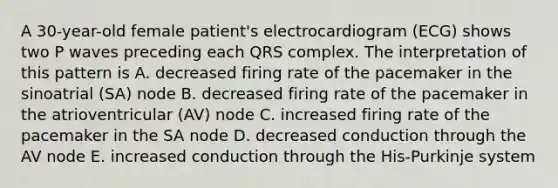 A 30-year-old female patient's electrocardiogram (ECG) shows two P waves preceding each QRS complex. The interpretation of this pattern is A. decreased firing rate of the pacemaker in the sinoatrial (SA) node B. decreased firing rate of the pacemaker in the atrioventricular (AV) node C. increased firing rate of the pacemaker in the SA node D. decreased conduction through the AV node E. increased conduction through the His-Purkinje system