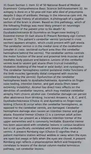 31 Exam Section 1: Item 32 of 50 National Board of Medical Examiners' Comprehensive Basic Science Self-Assessment 32. An autopsy is done on a 50-year-old man who died of pneumonia despite 5 days of antibiotic therapy in the intensive care unit. He had a 15-year history of alcoholism. A photograph of a sagittal section of the brain is shown. Based on this pathology, which of the following findings was most likely present on neurologic examination of the patient prior to his death? A) Dysdiadochokinesia B) Dysmetria on finger-nose testing C) Essential tremor D) Gait ataxia E) Present Romberg sign Correct Answer: D. This patient's cerebellar vermis (pictured in cross section) appears atrophic, which could present with gait ataxia. The cerebellar vermis is in the medial zone of the cerebellum (smaller in cross- sectional surface area than the cerebellar hemisphere behind the vermis). The cerebellar vermis controls the motor function of the axial and proximal limb muscles and mediates body posture and balance. Lesions of the cerebellar vermis lead to severe gait ataxia (from truncal instability), titubation (bobbing of the head or axial body), and nystagmus. The cerebellar hemispheres control ipsilateral motor functions of the limb muscles (generally distal compared with muscles controlled by the vermis). Dysfunction of the cerebellar hemispheres leads to dysdiadochokinesia, dysmetria on finger-nose testing, intention tremor, and gait ataxia (from lower extremity instability). Alcohol has direct toxic effects on the dendrites of cerebellar neurons, which may mediate cerebellar atrophy from chronic alcohol use. Cerebellar damage can persist after abstinence from drinking. Incorrect Answers: A, B, C, and E. Dysdiadochokinesia (Choice A) and dysmetria on finger-nose testing (Choice B) occur when the cerebellar hemispheres, as opposed to the cerebellar vermis, are damaged. Cerebellar hemisphere damage also causes an intention tremor and gait ataxia. Essential tremor (Choice C) is a common adult action tremor that can present as a bilateral intention tremor of the upper extremities and is commonly heritable. Essential tremor has been associated with cerebellar lesions in various locations but is not specifically correlated with lesions of the cerebellar vermis. A present Romberg sign (Choice E) signifies that a patient maintains station without wobble or sway when the eyes are open but sways or falls when the eyes are closed. A present Romberg sign reflects a proprioceptive deficit and frequently correlates to lesions of the dorsal column-medial lemniscus pathway, not cerebellar lesions.