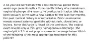 A 32-year-old G0 woman with a last menstrual period three weeks ago presents with a three-month history of a malodorous vaginal discharge. She reports no pruritus or irritation. She has been sexually active with a new partner for the last four months. Her past medical history is unremarkable. Pelvic examination reveals normal external genitalia without rash, ulcerations, or lesions. Some discharge is noted on the perineum. The vaginal exam reveals only a thin, gray homogeneous discharge. The vaginal pH is 5.0. A wet prep is shown in the image below. Which of the following is the most appropriate treatment for this patient?