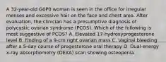 A 32-year-old G0P0 woman is seen in the office for irregular menses and excessive hair on the face and chest area. After evaluation, the clinician has a presumptive diagnosis of polycystic ovarian syndrome (PCOS). Which of the following is most suggestive of PCOS? A. Elevated 17-hydroxyprogesterone level B. Finding of a 9-cm right ovarian mass C. Vaginal bleeding after a 5-day course of progesterone oral therapy D. Dual-energy x-ray absorptiometry (DEXA) scan showing osteopenia