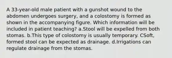 A 33-year-old male patient with a gunshot wound to the abdomen undergoes surgery, and a colostomy is formed as shown in the accompanying figure. Which information will be included in patient teaching? a.Stool will be expelled from both stomas. b.This type of colostomy is usually temporary. CSoft, formed stool can be expected as drainage. d.Irrigations can regulate drainage from the stomas.