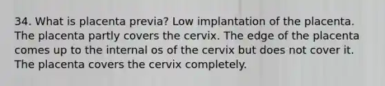 34. What is placenta previa? Low implantation of the placenta. The placenta partly covers the cervix. The edge of the placenta comes up to the internal os of the cervix but does not cover it. The placenta covers the cervix completely.