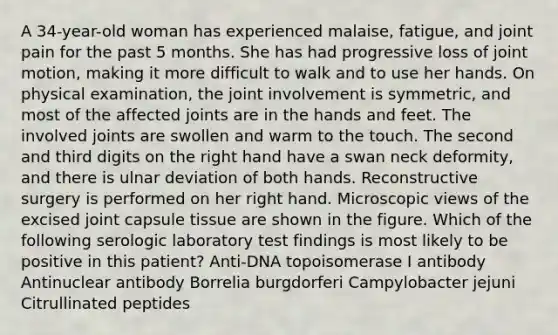 A 34-year-old woman has experienced malaise, fatigue, and joint pain for the past 5 months. She has had progressive loss of joint motion, making it more difficult to walk and to use her hands. On physical examination, the joint involvement is symmetric, and most of the affected joints are in the hands and feet. The involved joints are swollen and warm to the touch. The second and third digits on the right hand have a swan neck deformity, and there is ulnar deviation of both hands. Reconstructive surgery is performed on her right hand. Microscopic views of the excised joint capsule tissue are shown in the figure. Which of the following serologic laboratory test findings is most likely to be positive in this patient? Anti-DNA topoisomerase I antibody Antinuclear antibody Borrelia burgdorferi Campylobacter jejuni Citrullinated peptides