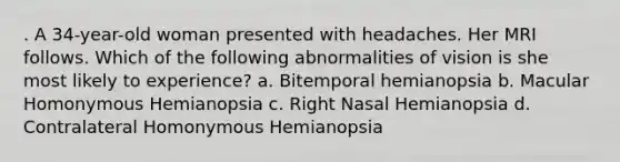 . A 34-year-old woman presented with headaches. Her MRI follows. Which of the following abnormalities of vision is she most likely to experience? a. Bitemporal hemianopsia b. Macular Homonymous Hemianopsia c. Right Nasal Hemianopsia d. Contralateral Homonymous Hemianopsia