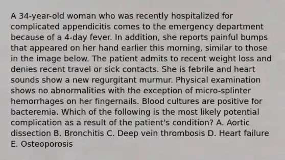 A 34-year-old woman who was recently hospitalized for complicated appendicitis comes to the emergency department because of a 4-day fever. In addition, she reports painful bumps that appeared on her hand earlier this morning, similar to those in the image below. The patient admits to recent weight loss and denies recent travel or sick contacts. She is febrile and heart sounds show a new regurgitant murmur. Physical examination shows no abnormalities with the exception of micro-splinter hemorrhages on her fingernails. Blood cultures are positive for bacteremia. Which of the following is the most likely potential complication as a result of the patient's condition? A. Aortic dissection B. Bronchitis C. Deep vein thrombosis D. Heart failure E. Osteoporosis