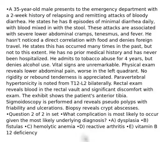 •A 35-year-old male presents to the emergency department with a 2-week history of relapsing and remitting attacks of bloody diarrhea. He states he has 8 episodes of minimal diarrhea daily, with blood mixed in with the stool. These attacks are associated with severe lower abdominal cramps, tenesmus, and fever. He hasn't noticed a direct correlation with food and denies foreign travel. He states this has occurred many times in the past, but not to this extent. He has no prior medical history and has never been hospitalized. He admits to tobacco abuse for 4 years, but denies alcohol use. Vital signs are unremarkable. Physical exam reveals lower abdominal pain, worse in the left quadrant. No rigidity or rebound tenderness is appreciated. Paravertebral hypertonicity is noted from T12-L2 bilaterally. Rectal exam reveals blood in the rectal vault and significant discomfort with exam. The exhibit shows the patient's anterior tibia. Sigmoidoscopy is performed and reveals pseudo polyps with friability and ulcerations. Biopsy reveals crypt abscesses. •Question 2 of 2 in set •What complication is most likely to occur given the most likely underlying diagnosis? •A) dysplasia •B) fistulas •C) hemolytic anemia •D) reactive arthritis •E) vitamin B 12 deficiency