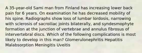 A 35-year-old Sami man from Finland has increasing lower back pain for 6 years. On examination he has decreased mobility of his spine. Radiographs show loss of lumbar lordosis, narrowing with sclerosis of sacroiliac joints bilaterally, and syndesmophyte formation at the junction of vertebrae and annulus fibrosus of intervertebral discs. Which of the following complications is most likely to develop in this man? Glomerulonephritis Hepatitis Malabsorption Meningitis Uveitis