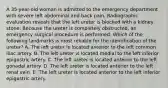 A 35-year-old woman is admitted to the emergency department with severe left abdominal and back pain. Radiographic evaluation reveals that the left ureter is blocked with a kidney stone. Because the ureter is completely obstructed, an emergency surgical procedure is performed. Which of the following landmarks is most reliable for the identification of the ureter? A. The left ureter is located anterior to the left common iliac artery. B. The left ureter is located medial to the left inferior epigastric artery. C. The left ureter is located anterior to the left gonadal artery. D. The left ureter is located anterior to the left renal vein. E. The left ureter is located anterior to the left inferior epigastric artery.