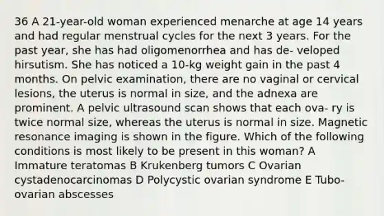 36 A 21-year-old woman experienced menarche at age 14 years and had regular menstrual cycles for the next 3 years. For the past year, she has had oligomenorrhea and has de- veloped hirsutism. She has noticed a 10-kg weight gain in the past 4 months. On pelvic examination, there are no vaginal or cervical lesions, the uterus is normal in size, and the adnexa are prominent. A pelvic ultrasound scan shows that each ova- ry is twice normal size, whereas the uterus is normal in size. Magnetic resonance imaging is shown in the figure. Which of the following conditions is most likely to be present in this woman? A Immature teratomas B Krukenberg tumors C Ovarian cystadenocarcinomas D Polycystic ovarian syndrome E Tubo-ovarian abscesses