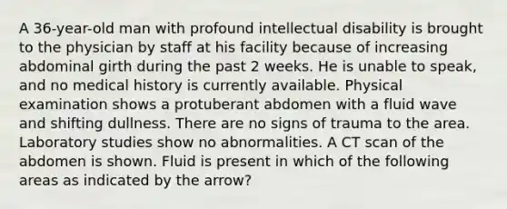 A 36-year-old man with profound intellectual disability is brought to the physician by staff at his facility because of increasing abdominal girth during the past 2 weeks. He is unable to speak, and no medical history is currently available. Physical examination shows a protuberant abdomen with a fluid wave and shifting dullness. There are no signs of trauma to the area. Laboratory studies show no abnormalities. A CT scan of the abdomen is shown. Fluid is present in which of the following areas as indicated by the arrow?