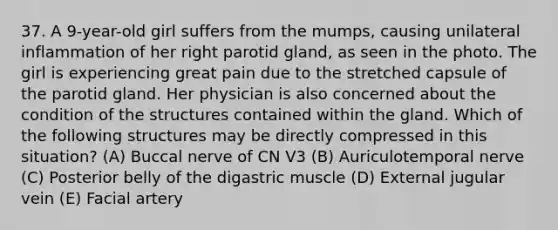 37. A 9-year-old girl suffers from the mumps, causing unilateral inflammation of her right parotid gland, as seen in the photo. The girl is experiencing great pain due to the stretched capsule of the parotid gland. Her physician is also concerned about the condition of the structures contained within the gland. Which of the following structures may be directly compressed in this situation? (A) Buccal nerve of CN V3 (B) Auriculotemporal nerve (C) Posterior belly of the digastric muscle (D) External jugular vein (E) Facial artery