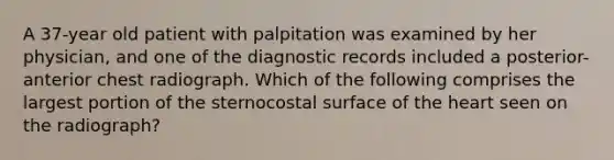 A 37-year old patient with palpitation was examined by her physician, and one of the diagnostic records included a posterior-anterior chest radiograph. Which of the following comprises the largest portion of the sternocostal surface of the heart seen on the radiograph?