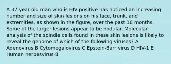 A 37-year-old man who is HIV-positive has noticed an increasing number and size of skin lesions on his face, trunk, and extremities, as shown in the figure, over the past 18 months. Some of the larger lesions appear to be nodular. Molecular analysis of the spindle cells found in these skin lesions is likely to reveal the genome of which of the following viruses? A Adenovirus B Cytomegalovirus C Epstein-Barr virus D HIV-1 E Human herpesvirus-8