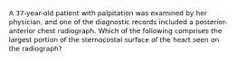 A 37-year-old patient with palpitation was examined by her physician, and one of the diagnostic records included a posterior-anterior chest radiograph. Which of the following comprises the largest portion of the sternocostal surface of the heart seen on the radiograph?