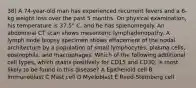 38) A 74-year-old man has experienced recurrent fevers and a 6-kg weight loss over the past 5 months. On physical examination, his temperature is 37.5° C, and he has splenomegaly. An abdominal CT scan shows mesenteric lymphadenopathy. A lymph node biopsy specimen shows effacement of the nodal architecture by a population of small lymphocytes, plasma cells, eosinophils, and macrophages. Which of the following additional cell types, which stains positively for CD15 and CD30, is most likely to be found in this disease? A Epithelioid cell B Immunoblast C Mast cell D Myeloblast E Reed-Sternberg cell