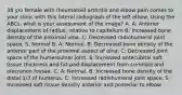 38 y/o female with rheumatoid arthritis and elbow pain comes to your clinic with this lateral radiograph of the left elbow. Using the ABCs, what is your assessment of the image? A. A: Anterior displacement of radius, relative to capitellum B: Increased bone density of the proximal ulna. C: Decreased radiohumeral joint space. S: Normal B. A: Normal. B: Decreased bone density of the anterior part of the proximal aspect of ulna. C: Decreased joint space of the humeroulnar joint. S: Increased antecubital soft tissue thickness and fat-pad displacement from coronoid and olecranon fossae. C. A: Normal. B: Increased bone density of the distal 1/3 of humerus. C: Increased radiohumeral joint space. S: Increased soft tissue density anterior and posterior to elbow