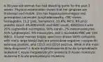 A 38-year-old woman has had bleeding gums for the past 3 weeks. Physical examination shows that her gingivae are thickened and friable. She has hepatosplenomegaly and generalized nontender lymphadenopathy. CBC shows hemoglobin, 11.2 g/dL; hematocrit, 33.9%; MCV, 89 μm3; platelet count, 95,000/mm3; and WBC count, 4500/mm3 with 25% segmented neutrophils, 10% bands, 2% metamyelocytes, 55% lymphocytes, 8% monocytes, and 1 nucleated RBC per 100 WBCs. A bone marrow biopsy specimen shows 100% cellularity, with many large blasts that are peroxidase negative, nonspecific esterase positive, and CD13 and CD14 positive. What is the most likely diagnosis? A Acute erythroleukemia B Acute lymphoblastic leukemia C Acute megakaryocytic leukemia D Acute monocytic leukemia E Acute promyelocytic leukemia