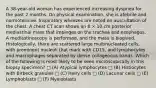 A 38-year-old woman has experienced increasing dyspnea for the past 2 months. On physical examination, she is afebrile and normotensive. Inspiratory wheezes are noted on auscultation of the chest. A chest CT scan shows an 8 × 10 cm posterior mediastinal mass that impinges on the trachea and esophagus. A mediastinoscopy is performed, and the mass is biopsied. Histologically, there are scattered large multinucleated cells, with prominent nucleoli that mark with CD15, and lymphocytes and macrophages separated by dense collagenous bands. Which of the following is most likely to be seen microscopically in this biopsy specimen? □ (A) Atypical lymphocytes □ (B) Histiocytes with Birbeck granules □ (C) Hairy cells □ (D) Lacunar cells □ (E) Lymphoblasts □ (F) Myeloblasts