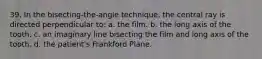 39. In the bisecting-the-angle technique, the central ray is directed perpendicular to: a. the film. b. the long axis of the tooth. c. an imaginary line bisecting the film and long axis of the tooth. d. the patient's Frankford Plane.