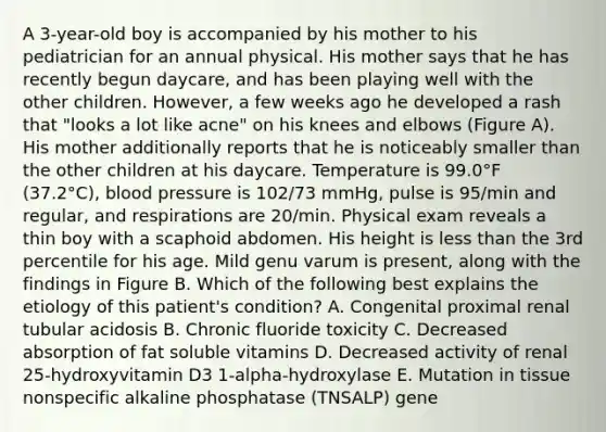 A 3-year-old boy is accompanied by his mother to his pediatrician for an annual physical. His mother says that he has recently begun daycare, and has been playing well with the other children. However, a few weeks ago he developed a rash that "looks a lot like acne" on his knees and elbows (Figure A). His mother additionally reports that he is noticeably smaller than the other children at his daycare. Temperature is 99.0°F (37.2°C), blood pressure is 102/73 mmHg, pulse is 95/min and regular, and respirations are 20/min. Physical exam reveals a thin boy with a scaphoid abdomen. His height is less than the 3rd percentile for his age. Mild genu varum is present, along with the findings in Figure B. Which of the following best explains the etiology of this patient's condition? A. Congenital proximal renal tubular acidosis B. Chronic fluoride toxicity C. Decreased absorption of fat soluble vitamins D. Decreased activity of renal 25-hydroxyvitamin D3 1-alpha-hydroxylase E. Mutation in tissue nonspecific alkaline phosphatase (TNSALP) gene