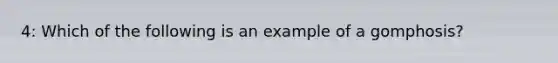 4: Which of the following is an example of a gomphosis?