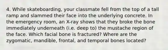 4. While skateboarding, your classmate fell from the top of a tall ramp and slammed their face into the underlying concrete. In the emergency room, an X-ray shows that they broke the bone immediately underneath (i.e. deep to) the mustache region of the face. Which facial bone is fractured? Where are the zygomatic, mandible, frontal, and temporal bones located?