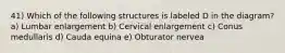 41) Which of the following structures is labeled D in the diagram? a) Lumbar enlargement b) Cervical enlargement c) Conus medullaris d) Cauda equina e) Obturator nervea