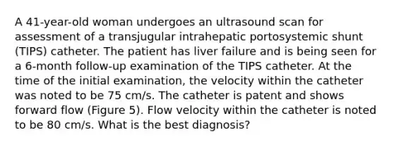 A 41-year-old woman undergoes an ultrasound scan for assessment of a transjugular intrahepatic portosystemic shunt (TIPS) catheter. The patient has liver failure and is being seen for a 6-month follow-up examination of the TIPS catheter. At the time of the initial examination, the velocity within the catheter was noted to be 75 cm/s. The catheter is patent and shows forward flow (Figure 5). Flow velocity within the catheter is noted to be 80 cm/s. What is the best diagnosis?