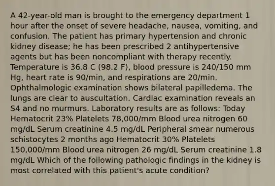 A 42-year-old man is brought to the emergency department 1 hour after the onset of severe headache, nausea, vomiting, and confusion. The patient has primary hypertension and chronic kidney disease; he has been prescribed 2 antihypertensive agents but has been noncompliant with therapy recently. Temperature is 36.8 C (98.2 F), blood pressure is 240/150 mm Hg, heart rate is 90/min, and respirations are 20/min. Ophthalmologic examination shows bilateral papilledema. The lungs are clear to auscultation. Cardiac examination reveals an S4 and no murmurs. Laboratory results are as follows: Today Hematocrit 23% Platelets 78,000/mm Blood urea nitrogen 60 mg/dL Serum creatinine 4.5 mg/dL Peripheral smear numerous schistocytes 2 months ago Hematocrit 30% Platelets 150,000/mm Blood urea nitrogen 26 mg/dL Serum creatinine 1.8 mg/dL Which of the following pathologic findings in the kidney is most correlated with this patient's acute condition?