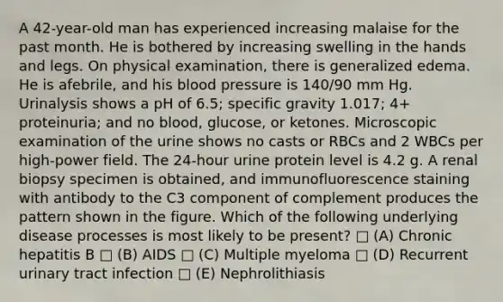 A 42-year-old man has experienced increasing malaise for the past month. He is bothered by increasing swelling in the hands and legs. On physical examination, there is generalized edema. He is afebrile, and his <a href='https://www.questionai.com/knowledge/kD0HacyPBr-blood-pressure' class='anchor-knowledge'>blood pressure</a> is 140/90 mm Hg. Urinalysis shows a pH of 6.5; specific gravity 1.017; 4+ proteinuria; and no blood, glucose, or ketones. Microscopic examination of the urine shows no casts or RBCs and 2 WBCs per high-power field. The 24-hour urine protein level is 4.2 g. A renal biopsy specimen is obtained, and immunofluorescence staining with antibody to the C3 component of complement produces the pattern shown in the figure. Which of the following underlying disease processes is most likely to be present? □ (A) Chronic hepatitis B □ (B) AIDS □ (C) Multiple myeloma □ (D) Recurrent urinary tract infection □ (E) Nephrolithiasis