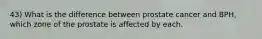 43) What is the difference between prostate cancer and BPH, which zone of the prostate is affected by each.