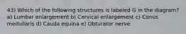 43) Which of the following structures is labeled G in the diagram? a) Lumbar enlargement b) Cervical enlargement c) Conus medullaris d) Cauda equina e) Obturator nerve