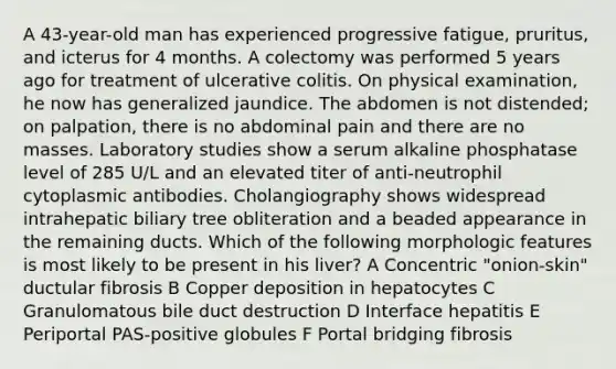 A 43-year-old man has experienced progressive fatigue, pruritus, and icterus for 4 months. A colectomy was performed 5 years ago for treatment of ulcerative colitis. On physical examination, he now has generalized jaundice. The abdomen is not distended; on palpation, there is no abdominal pain and there are no masses. Laboratory studies show a serum alkaline phosphatase level of 285 U/L and an elevated titer of anti-neutrophil cytoplasmic antibodies. Cholangiography shows widespread intrahepatic biliary tree obliteration and a beaded appearance in the remaining ducts. Which of the following morphologic features is most likely to be present in his liver? A Concentric "onion-skin" ductular fibrosis B Copper deposition in hepatocytes C Granulomatous bile duct destruction D Interface hepatitis E Periportal PAS-positive globules F Portal bridging fibrosis