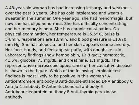 A 43-year-old woman has had increasing lethargy and weakness over the past 3 years. She has cold intolerance and wears a sweater in the summer. One year ago, she had menorrhagia, but now she has oligomenorrhea. She has difficulty concentrating, and her memory is poor. She has chronic constipation. On physical examination, her temperature is 35.5° C, pulse is 54/min, respirations are 13/min, and blood pressure is 110/70 mm Hg. She has alopecia, and her skin appears coarse and dry. Her face, hands, and feet appear puffy, with doughlike skin. Laboratory findings show hemoglobin, 13.8 g/dL; hematocrit, 41.5%; glucose, 73 mg/dL; and creatinine, 1.1 mg/dL. The representative microscopic appearance of her causative disease is shown in the figure. Which of the following serologic test findings is most likely to be positive in this woman? A Anticentromere antibody B Anti-double-stranded DNA antibody C Anti-Jo-1 antibody D Antimitochondrial antibody E Antiribonucleoprotein antibody F Anti-thyroid peroxidase antibody