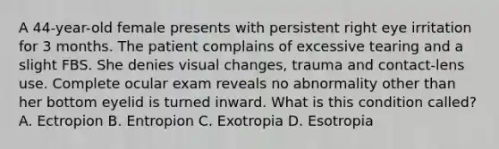 A 44-year-old female presents with persistent right eye irritation for 3 months. The patient complains of excessive tearing and a slight FBS. She denies visual changes, trauma and contact-lens use. Complete ocular exam reveals no abnormality other than her bottom eyelid is turned inward. What is this condition called? A. Ectropion B. Entropion C. Exotropia D. Esotropia