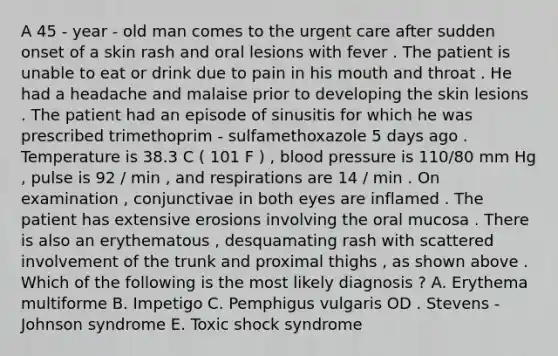 A 45 - year - old man comes to the urgent care after sudden onset of a skin rash and oral lesions with fever . The patient is unable to eat or drink due to pain in his mouth and throat . He had a headache and malaise prior to developing the skin lesions . The patient had an episode of sinusitis for which he was prescribed trimethoprim - sulfamethoxazole 5 days ago . Temperature is 38.3 C ( 101 F ) , blood pressure is 110/80 mm Hg , pulse is 92 / min , and respirations are 14 / min . On examination , conjunctivae in both eyes are inflamed . The patient has extensive erosions involving the oral mucosa . There is also an erythematous , desquamating rash with scattered involvement of the trunk and proximal thighs , as shown above . Which of the following is the most likely diagnosis ? A. Erythema multiforme B. Impetigo C. Pemphigus vulgaris OD . Stevens - Johnson syndrome E. Toxic shock syndrome