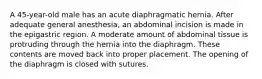 A 45-year-old male has an acute diaphragmatic hernia. After adequate general anesthesia, an abdominal incision is made in the epigastric region. A moderate amount of abdominal tissue is protruding through the hernia into the diaphragm. These contents are moved back into proper placement. The opening of the diaphragm is closed with sutures.