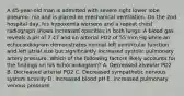 A 45-year-old man is admitted with severe right lower lobe pneumo- nia and is placed on mechanical ventilation. On the 2nd hospital day, his hypoxemia worsens and a repeat chest radiograph shows increased opacities in both lungs. A blood gas reveals a pH of 7.47 and an arterial PO2 of 55 mm Hg while an echocardiogram demonstrates normal left ventricular function and left atrial size but significantly increased systolic pulmonary artery pressure. Which of the following factors likely accounts for the findings on his echocardiogram? A. Decreased alveolar PO2 B. Decreased arterial PO2 C. Decreased sympathetic nervous system activity D. Increased blood pH E. Increased pulmonary venous pressure