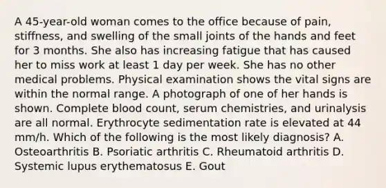 A 45-year-old woman comes to the office because of pain, stiffness, and swelling of the small joints of the hands and feet for 3 months. She also has increasing fatigue that has caused her to miss work at least 1 day per week. She has no other medical problems. Physical examination shows the vital signs are within the normal range. A photograph of one of her hands is shown. Complete blood count, serum chemistries, and urinalysis are all normal. Erythrocyte sedimentation rate is elevated at 44 mm/h. Which of the following is the most likely diagnosis? A. Osteoarthritis B. Psoriatic arthritis C. Rheumatoid arthritis D. Systemic lupus erythematosus E. Gout